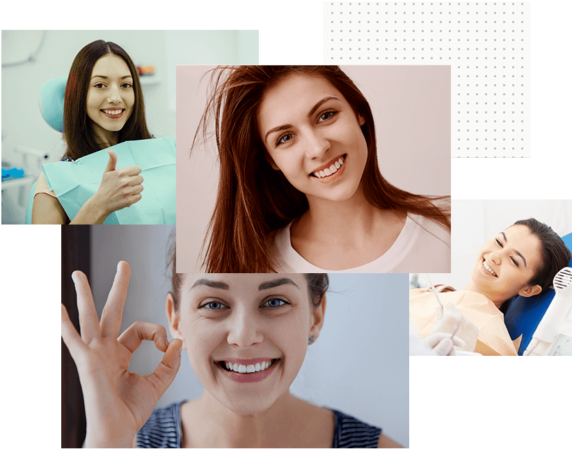 Dental Veneers